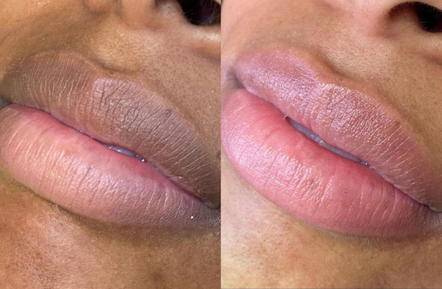 Lip Neutralization Tattoo | Brandylynn Permanent Makeup